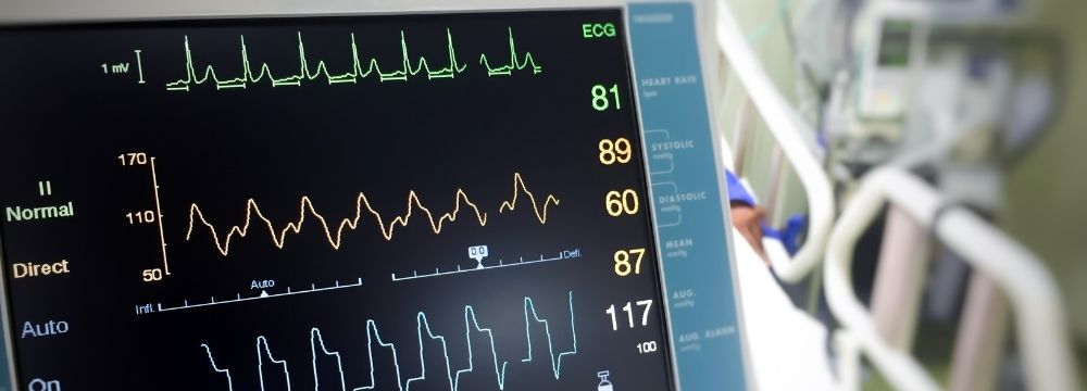 EKG measures electrical signals in your heart, but may not catch all abnormalities or arrhythmias according the Nevada Cardiology