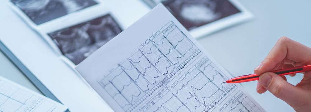 Doctor examining EKG reading with red pen 